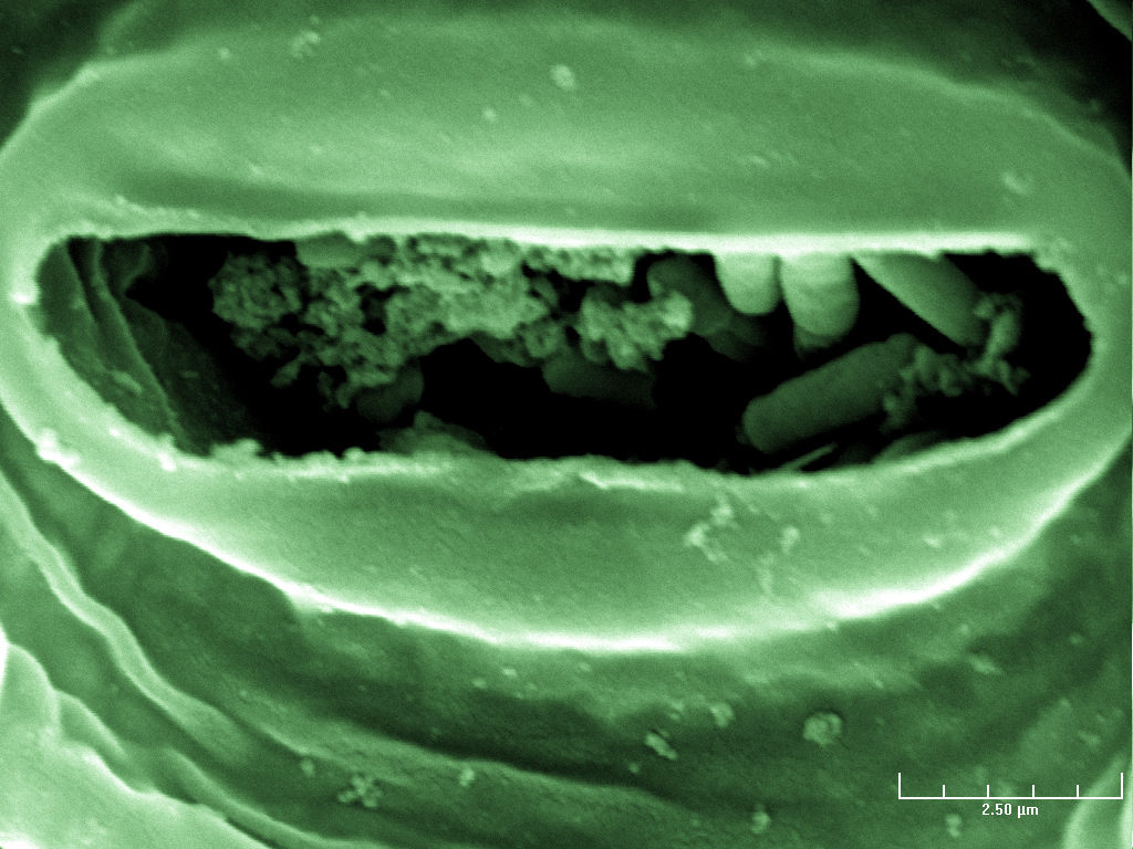 Electron microscope image of green-leaf lettuce with E. coli bacteria