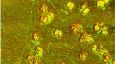 A dozen irregular-shaped herpes simplex virus particles