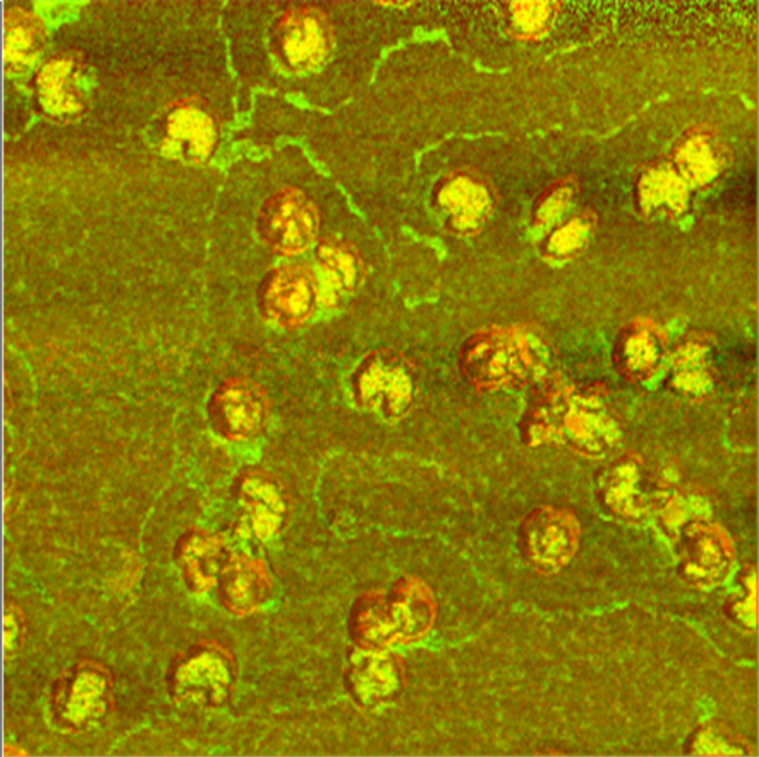 A dozen irregular-shaped herpes simplex virus particles
