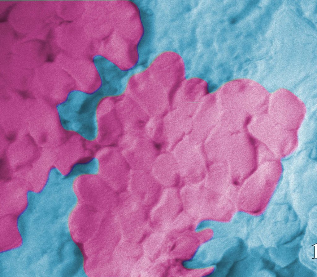 A pink blob within a light blue blob - the pink is a microscope image of bacteria on a blue disposable glove