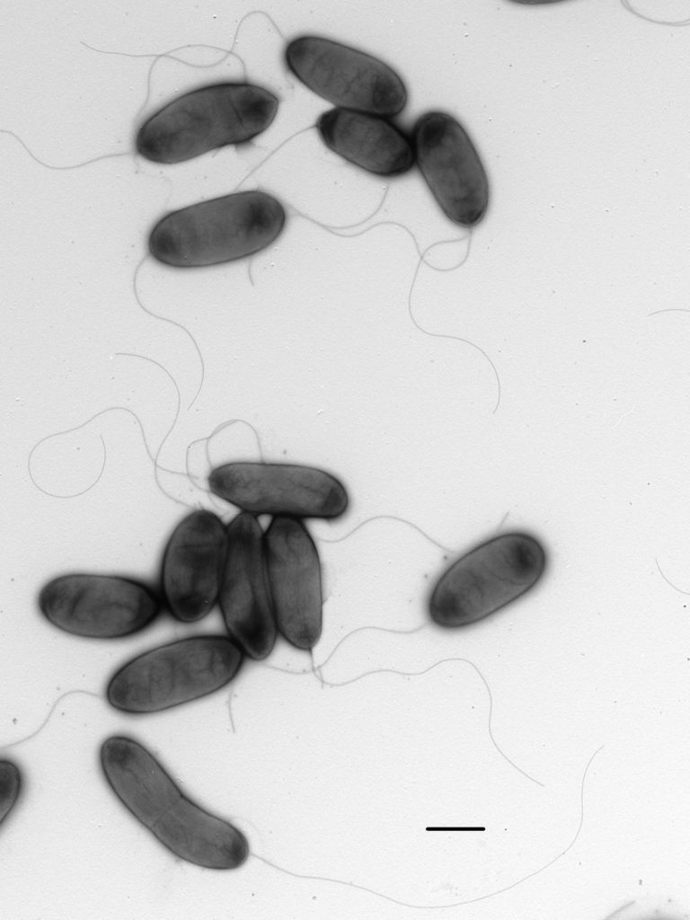 oblong black objects with tiny strings attached, Bacterium magnified by electron microscope.