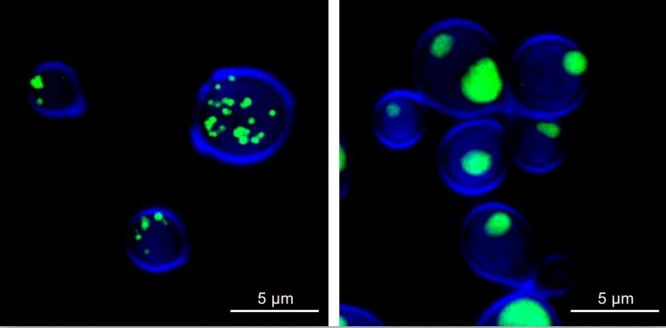 Side-by-side confocal microscopic image of Cryptococcus cells exposed to sertraline depicted by blue circles and green spots that are larger on one side than the other