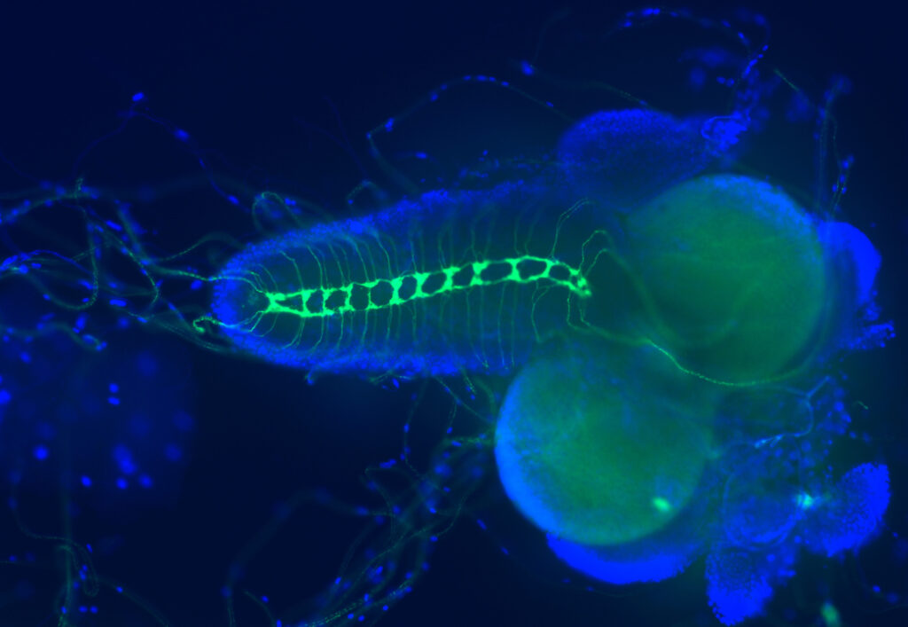 A fruit fly larval brain with blue and green fluorescence showing the normal arrangement of axons (no muscular distrophy-related mutations)