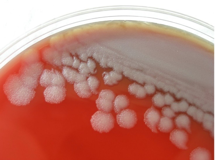 Una muestra de ántrax en una placa de Petri después de la incubación.